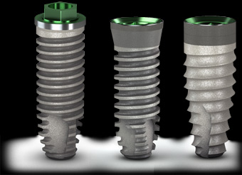 There are many different types of dental implants used in Costa Rica