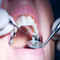 Costa Rican Dental offers piece of mind when going for dental work in Costa Rica.